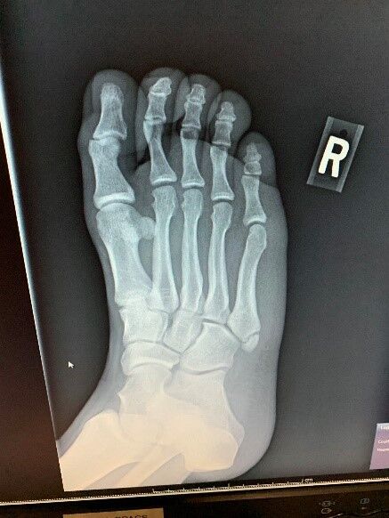 foot-radiography.jpg